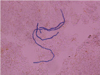 Fig.1