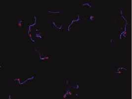 CTC/DAPI dF