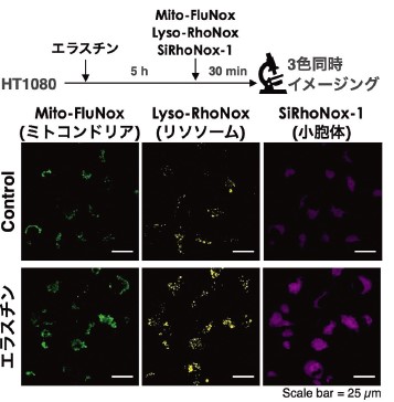 図6．フェロトーシスにおける各小器官の二価鉄蛍光イメージング