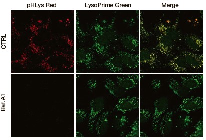 Lysosomal Acidic pH Detection Kitによるリソソーム pH 変化のイメージング